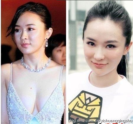 Điểm danh sao nữ Hoa Ngữ đổi đời nhờ phẫu thuật thẩm mỹ