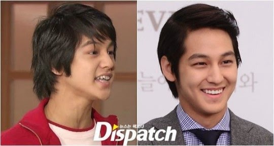 Dispatch tiết lộ 'phép màu kỳ diệu' hơn cả phẫu thuật thẩm mỹ khiến thần tượng xinh đẹp hơn