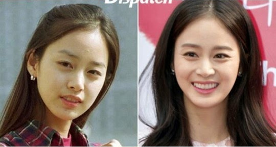 Dispatch tiết lộ 'phép màu kỳ diệu' hơn cả phẫu thuật thẩm mỹ khiến thần tượng xinh đẹp hơn