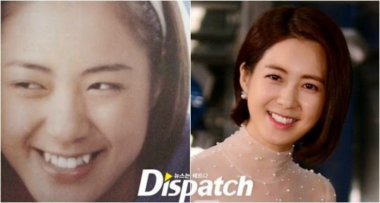 Dispatch tiết lộ 'phép màu kỳ diệu' hơn cả phẫu thuật thẩm mỹ khiến thần tượng xinh đẹp hơn