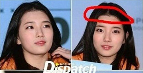 'Tình đầu quốc dân' Suzy bị tố phẫu thuật thẩm mỹ nhiều lần