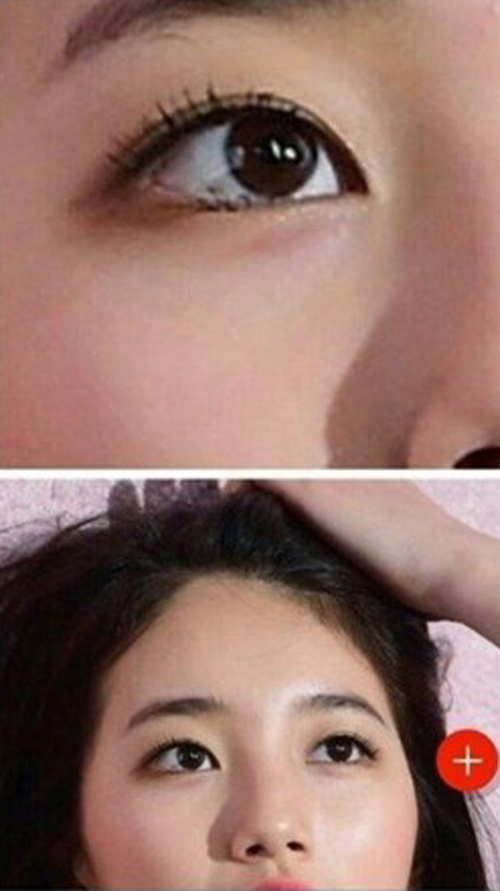 'Tình đầu quốc dân' Suzy bị tố phẫu thuật thẩm mỹ nhiều lần