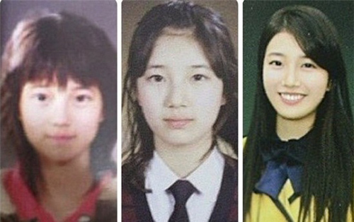 'Tình đầu quốc dân' Suzy bị tố phẫu thuật thẩm mỹ nhiều lần