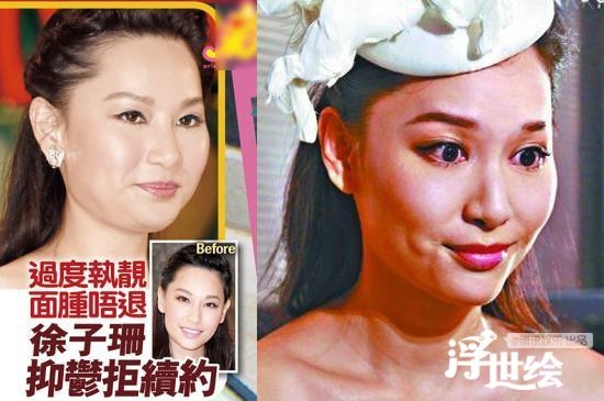 Những nụ cười méo xệch gây tranh cãi của dàn mỹ nhân Hoa ngữ