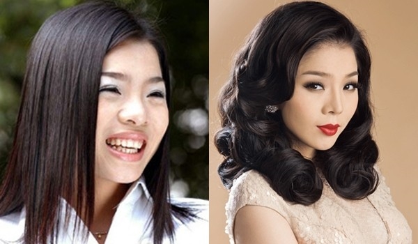 Trước Lưu Hương Giang, mỹ nhân Việt nào đã thừa nhận phẫu thuật thẩm mỹ