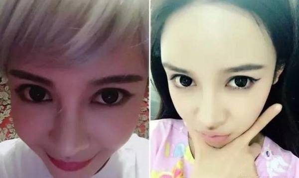 Bản sao hoàn mỹ nhất của AngelaBaby chi tiền khủng để sửa mặt