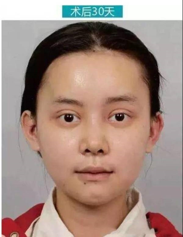 Bản sao hoàn mỹ nhất của AngelaBaby chi tiền khủng để sửa mặt