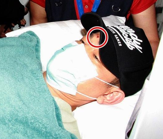 Lưu Đức Hoa cần đến 7 người chăm sóc tại bệnh viện