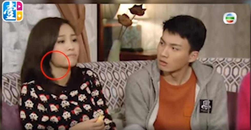 Fan hết hồn vì hoa đán TVB để lộ khối u to như bóng bàn ở cổ