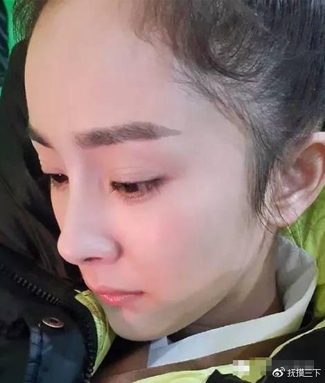 Fan xót xa vì Lâm Tâm Như bị rụng tóc sau khi sinh con gái