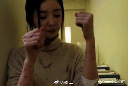 Fan xót xa vì Dương Mịch bầm dập, thương tích đầy người vì phim mới