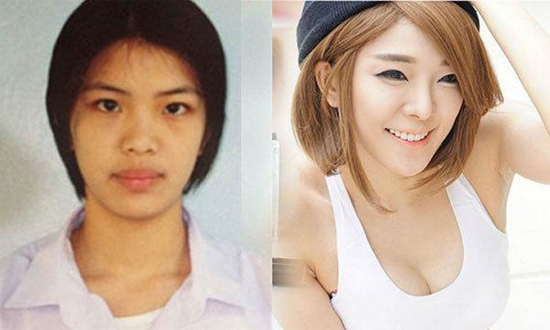 10 sao nữ Thái lên đời nhan sắc nhờ 'đập mặt đi xây lại'