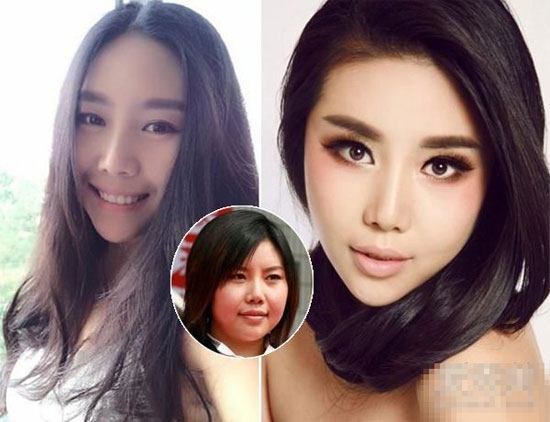 10 sao Hoa ngữ bị 'bóc mẽ' phẫu thuật thẩm mỹ