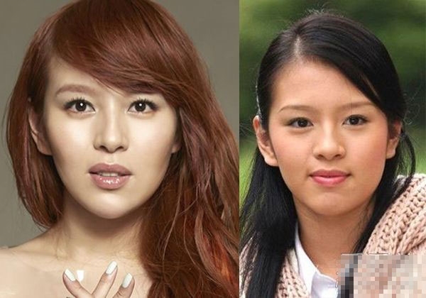 10 sao Hoa ngữ bị 'bóc mẽ' phẫu thuật thẩm mỹ
