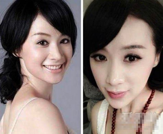 10 sao Hoa ngữ bị 'bóc mẽ' phẫu thuật thẩm mỹ