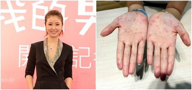 Hoắc Kiến Hoa được Lâm Tâm Như 'đền bù' vì con gái quá nhỏ