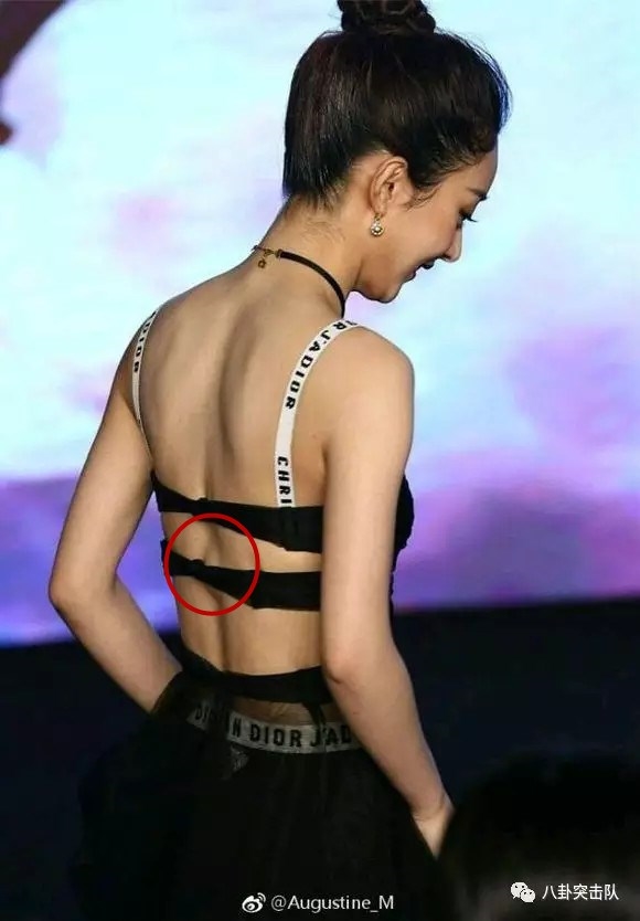 Những lần mang theo bệnh tật đến phim trường của sao Hoa ngữ