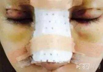 Quá hâm mộ Địch Lệ Nhiệt Ba, cô gái này đã bỏ tiền để PTTM giống idol