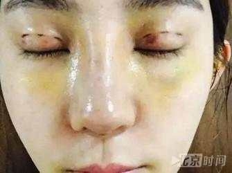 Quá hâm mộ Địch Lệ Nhiệt Ba, cô gái này đã bỏ tiền để PTTM giống idol