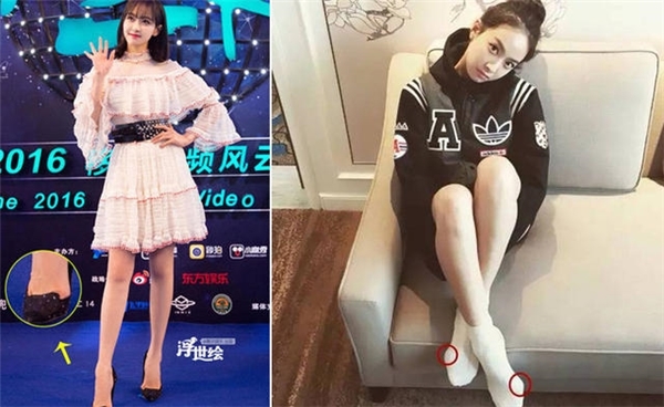 Mê giày cao gót, hàng loạt mỹ nhân Hoa ngữ gánh chịu hậu quả đáng sợ