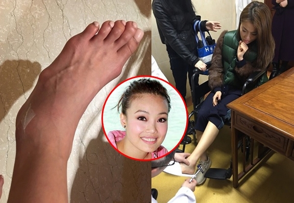 Mê giày cao gót, hàng loạt mỹ nhân Hoa ngữ gánh chịu hậu quả đáng sợ