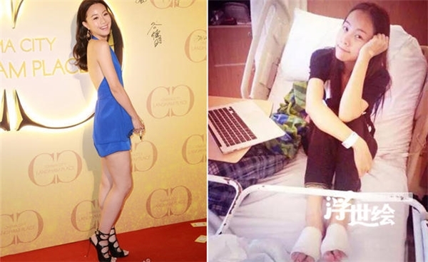 Mê giày cao gót, hàng loạt mỹ nhân Hoa ngữ gánh chịu hậu quả đáng sợ