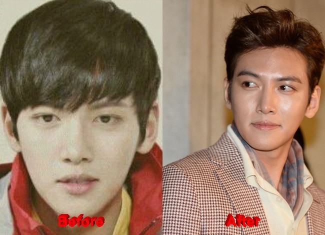 Hết chuyện để làm, dân mạng “tố” Ji Chang Wook phẫu thuật thẩm mỹ
