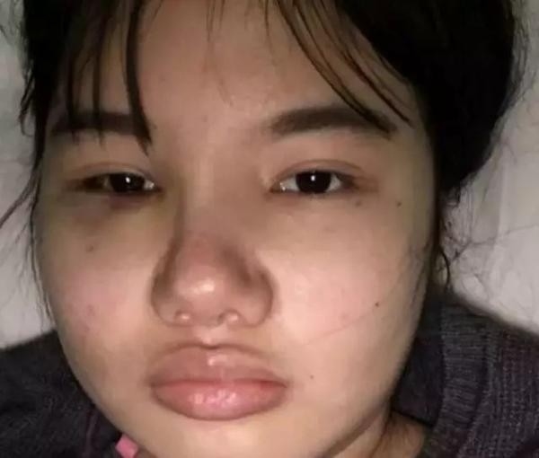 Dương Mịch đau đầu vì fan cuồng lại chi tiền tỷ để dao kéo khuôn mặt