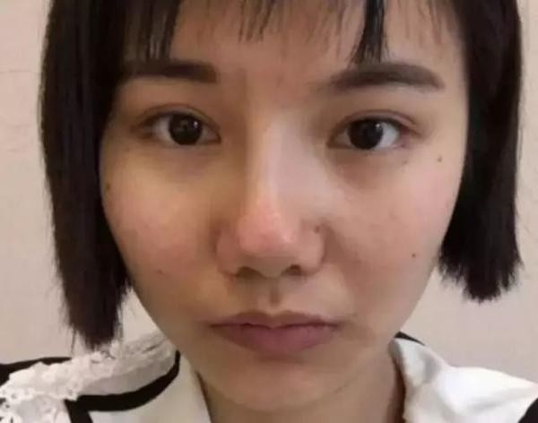 Dương Mịch đau đầu vì fan cuồng lại chi tiền tỷ để dao kéo khuôn mặt
