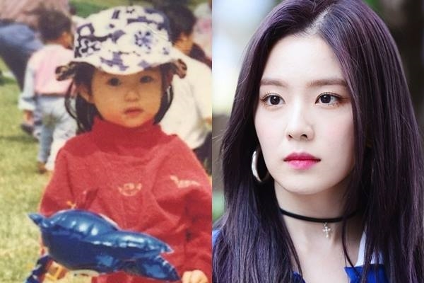 Ảnh trước khi ra mắt của Irene : một ca phẫu thuật thành công