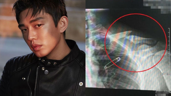 Yoo Ah In được chẩn đoán mắc bệnh tâm lý nghiêm trọng