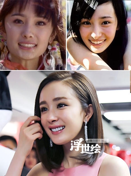 Sao Hoa ngữ chỉ cần chỉnh lại răng đã đẹp thế này đây