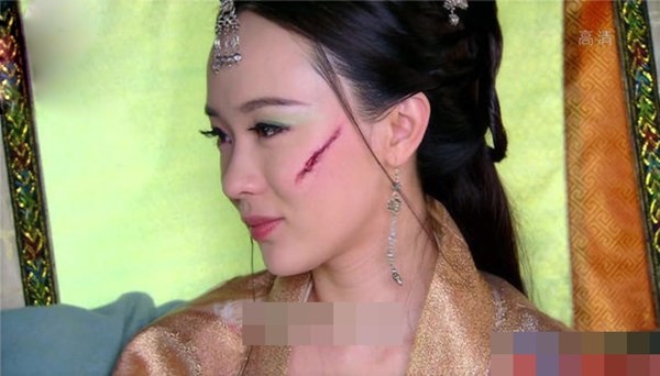 Xót xa khi nhìn những mỹ nhân yêu kiều bị hủy dung nhan