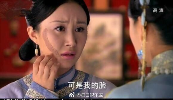 Xót xa khi nhìn những mỹ nhân yêu kiều bị hủy dung nhan
