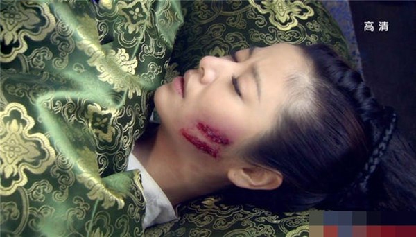 Xót xa khi nhìn những mỹ nhân yêu kiều bị hủy dung nhan
