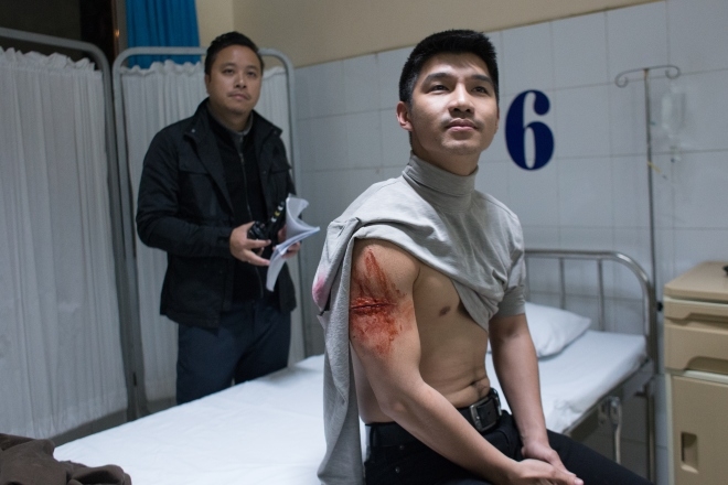 Sao Việt gặp chấn thương nguy hiểm trên phim trường