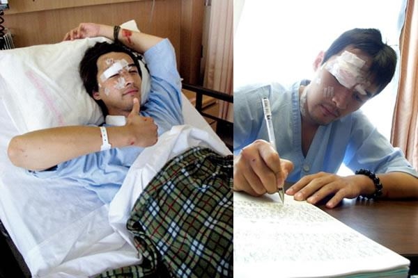 Những ngôi sao Hoa ngữ gặp tai nạn kinh hoàng ngay tại phim trường