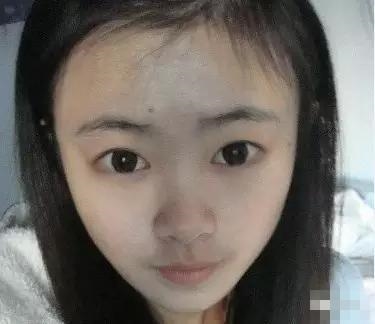 Bất ngờ với phương pháp soi mũi dao kéo của dàn sao Hoa ngữ