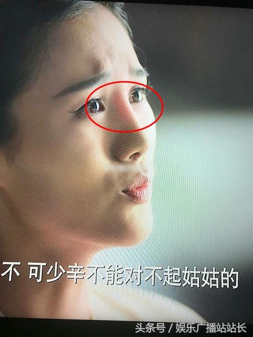 Bất ngờ với phương pháp soi mũi dao kéo của dàn sao Hoa ngữ