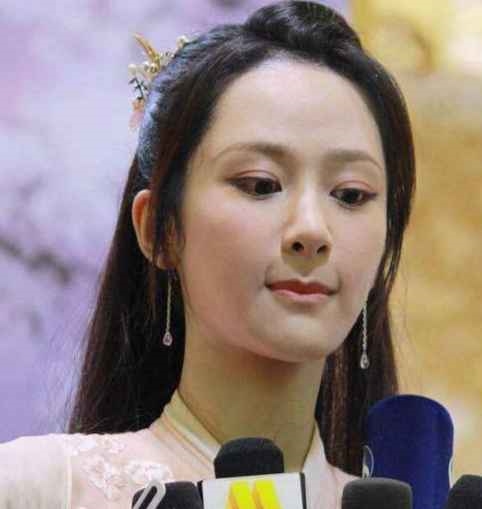 Những tiểu hoa đán Cbiz lao đao với tin đồn dao kéo vì mặt cứng đờ