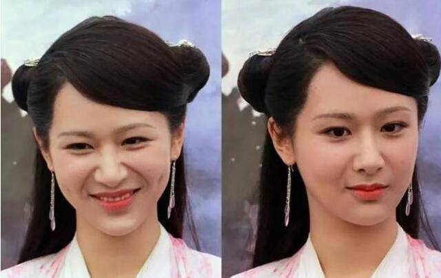 Những tiểu hoa đán Cbiz lao đao với tin đồn dao kéo vì mặt cứng đờ