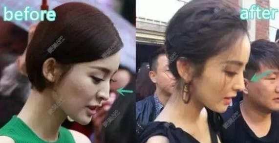 Cổ Lực Na Trát lại rạng rỡ như chưa từng là thảm họa thẩm mỹ