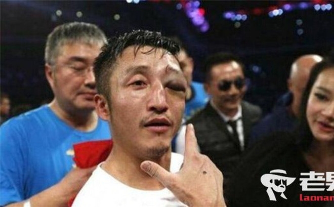 Nghệ sĩ Cbiz bị bóc lột sức lao động, bị khinh rẻ vì không có tên tuổi