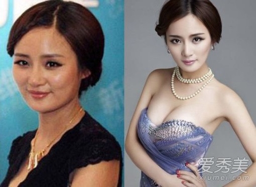 Thẳng thắn thừa nhận đã phẫu thuật thẩm mỹ, có những ngôi sao nào?