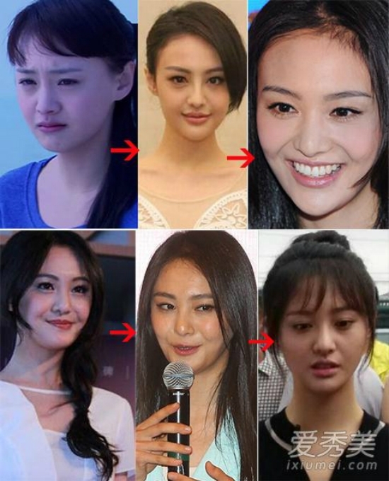 Thẳng thắn thừa nhận đã phẫu thuật thẩm mỹ, có những ngôi sao nào?