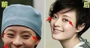 Thẳng thắn thừa nhận đã phẫu thuật thẩm mỹ, có những ngôi sao nào?