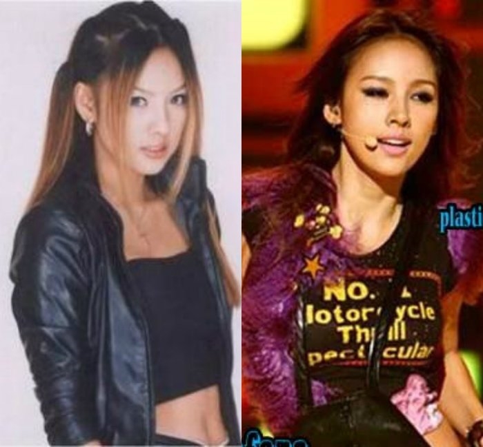 Những mỹ nhân Hàn từng dính nghi án bơm ngực