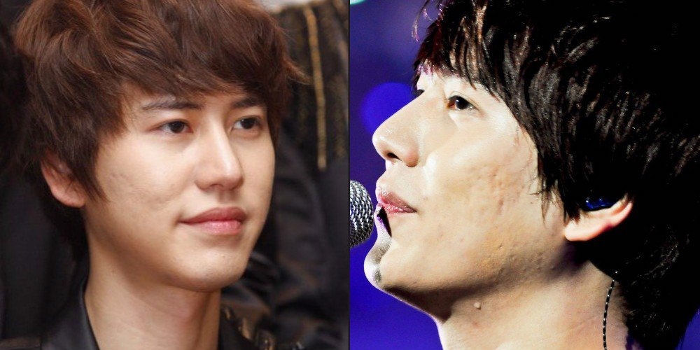 Muôn kiểu mặt mộc của những nam thần Kpop