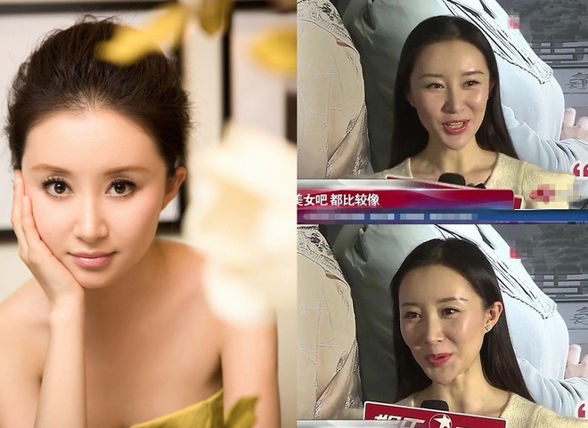 Mỹ nhân Hoa ngữ thất bại trong sự nghiệp vì phẫu thuật thẩm mỹ