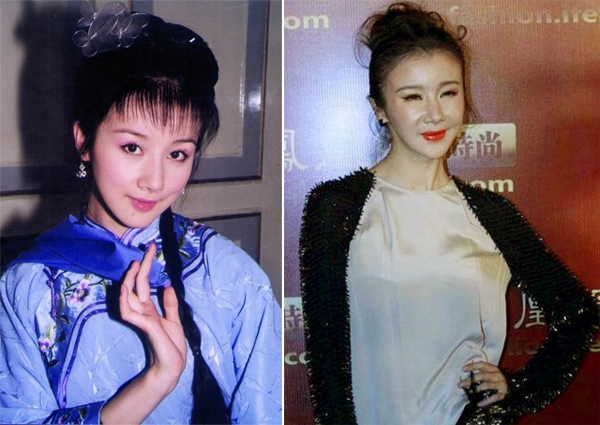 Mỹ nhân Hoa ngữ thất bại trong sự nghiệp vì phẫu thuật thẩm mỹ